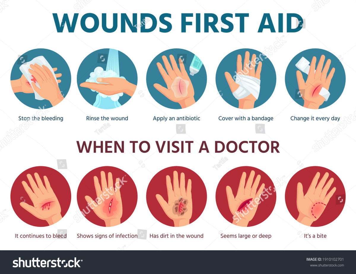 Sanitäter warnen: Diesen Fehler machen 90 Prozent bei Wunden im Garten - image 1